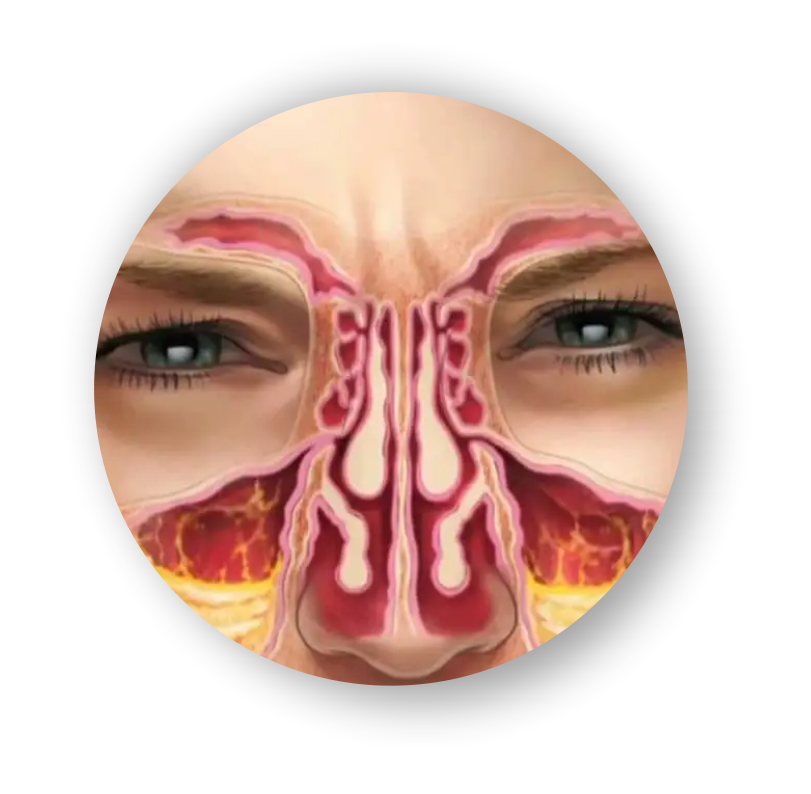 resp.png resp.png